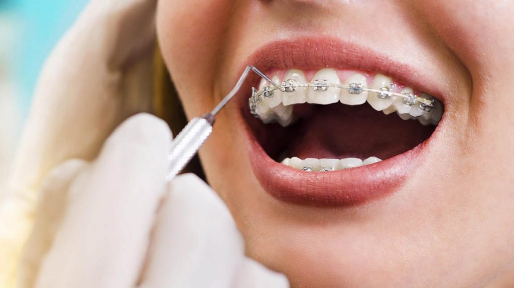 Welcome to Mounikas Multi Speciality Dental Clinic: Your Partner in Oral Health